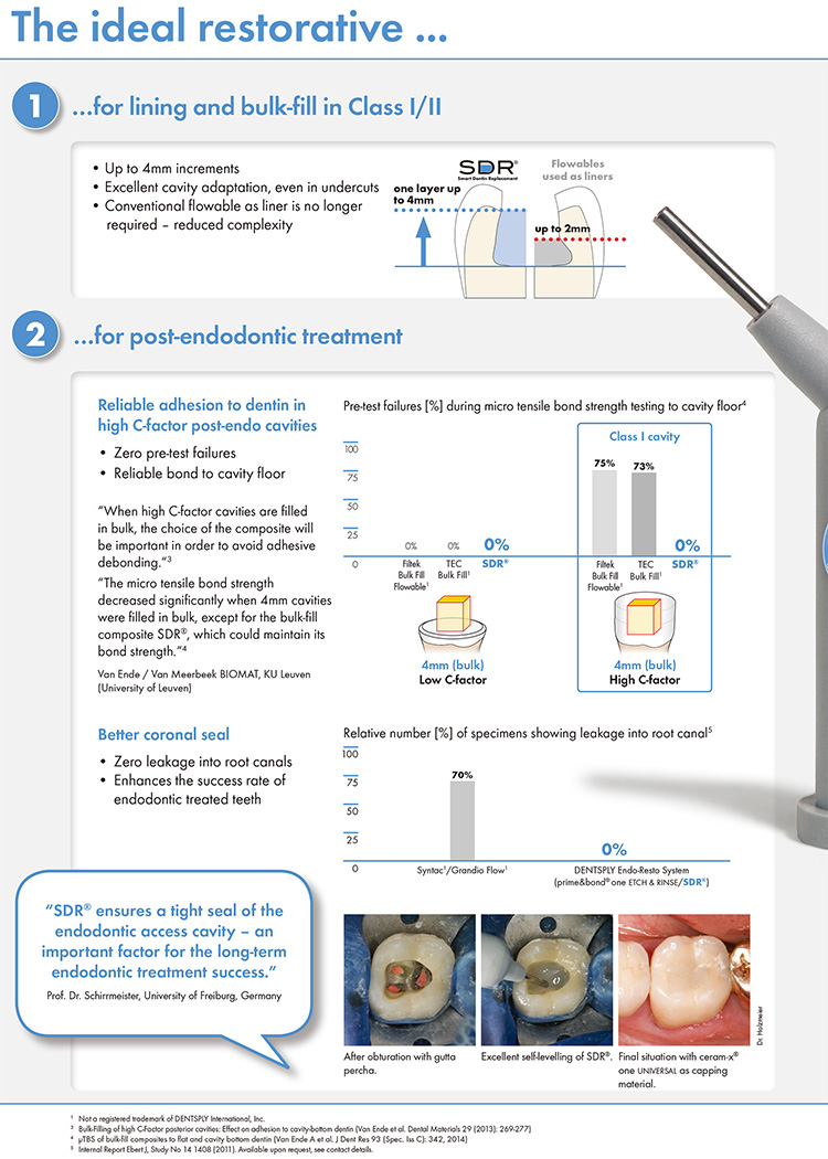 SDR Smart Dentin Replacement